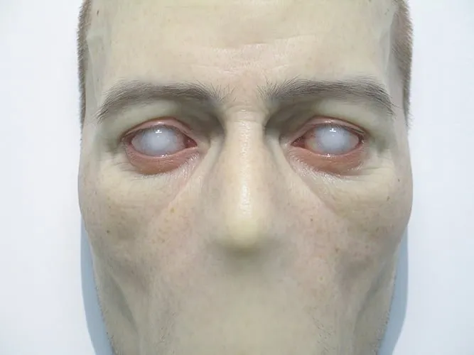 Untitled, 2007 — escultura hiperrealista de Sam Jinks