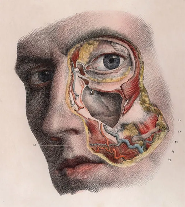 Nicolas Henri Jacob: disección de la órbita ocular