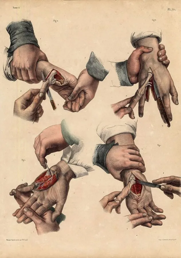 Nicolas Henri Jacob: cirugía de mano y muñeca