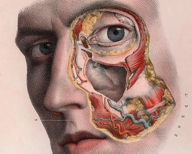Atlas de anatomía humana y cirugía del siglo XIX