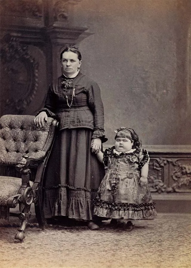 Mujer y niña de rasgos poco convencionales en un retrato de estudio