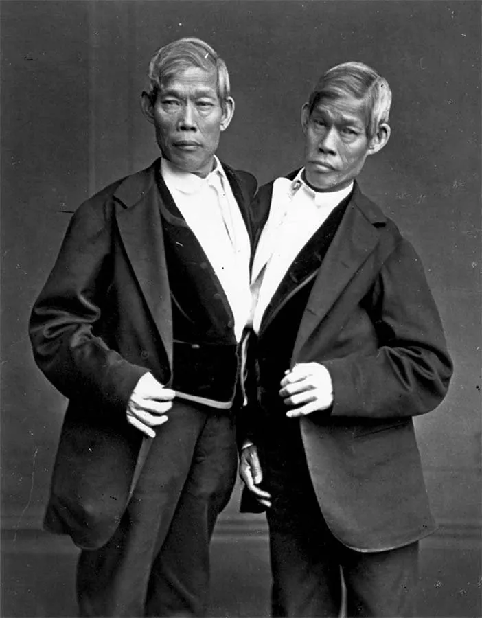 Ghang eng gemelos siameses