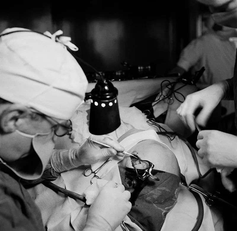 Una lobotomía en curso en el Södersjukhuset de Estocolmo (1949), fotografiada por Lennart Nilsson.