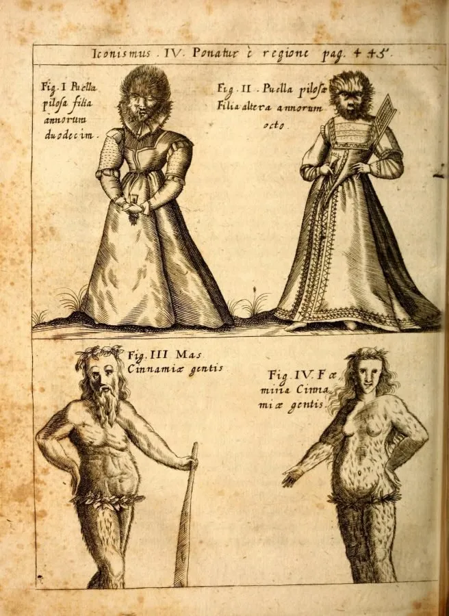 Niñas y adultos con hipertricosis, grabado de «Physica Curiosa» (1662)