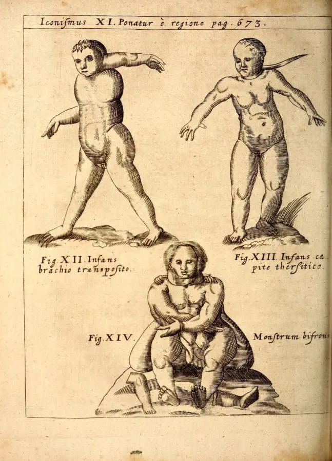 Infantes deformes y monstruo de dos caras, grabado de «Physica Curiosa» (1662)