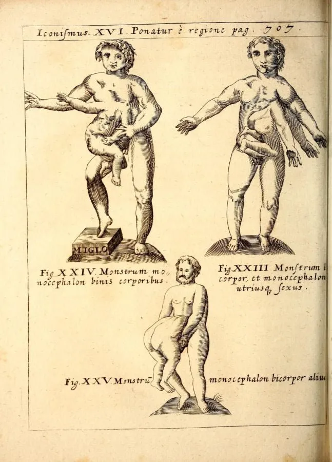 Monstruos de una cabeza y dos cuerpos, grabado de «Physica Curiosa» (1662)